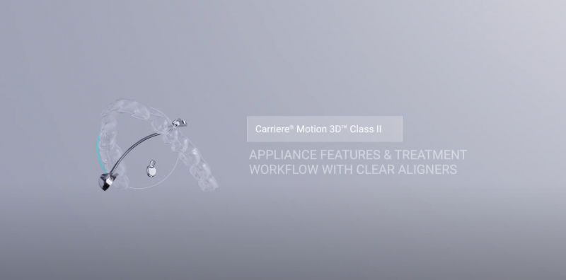 Carriere Motion 3D Class II & Aligners: Doctors Education1